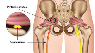 Diagram of the anatomy of the hip joint and the muscles